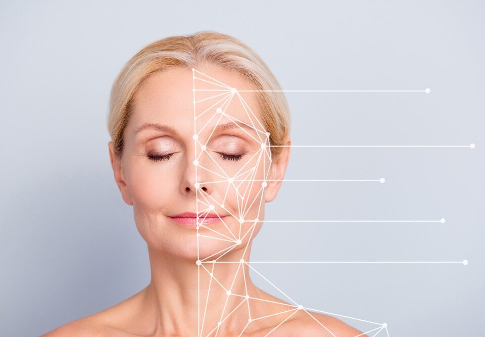 resultat lifting visage