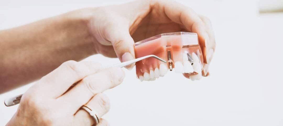 retrait implant dentaire turquie