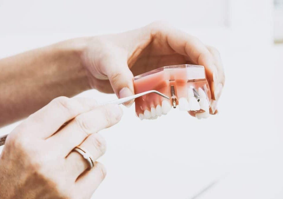 retrait implant dentaire turquie
