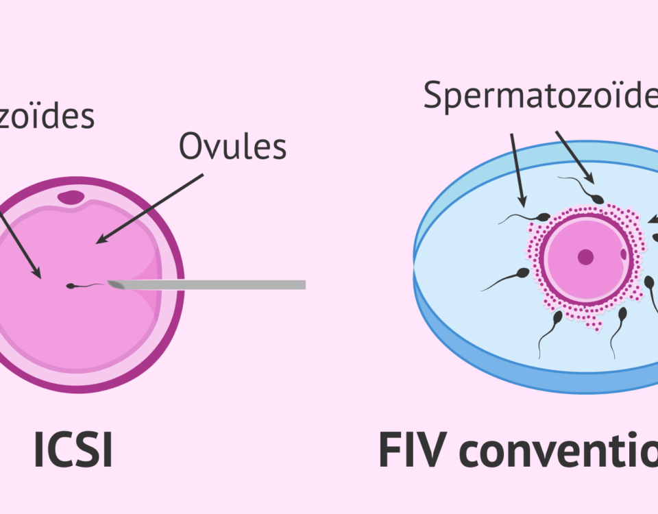 fiv icsi