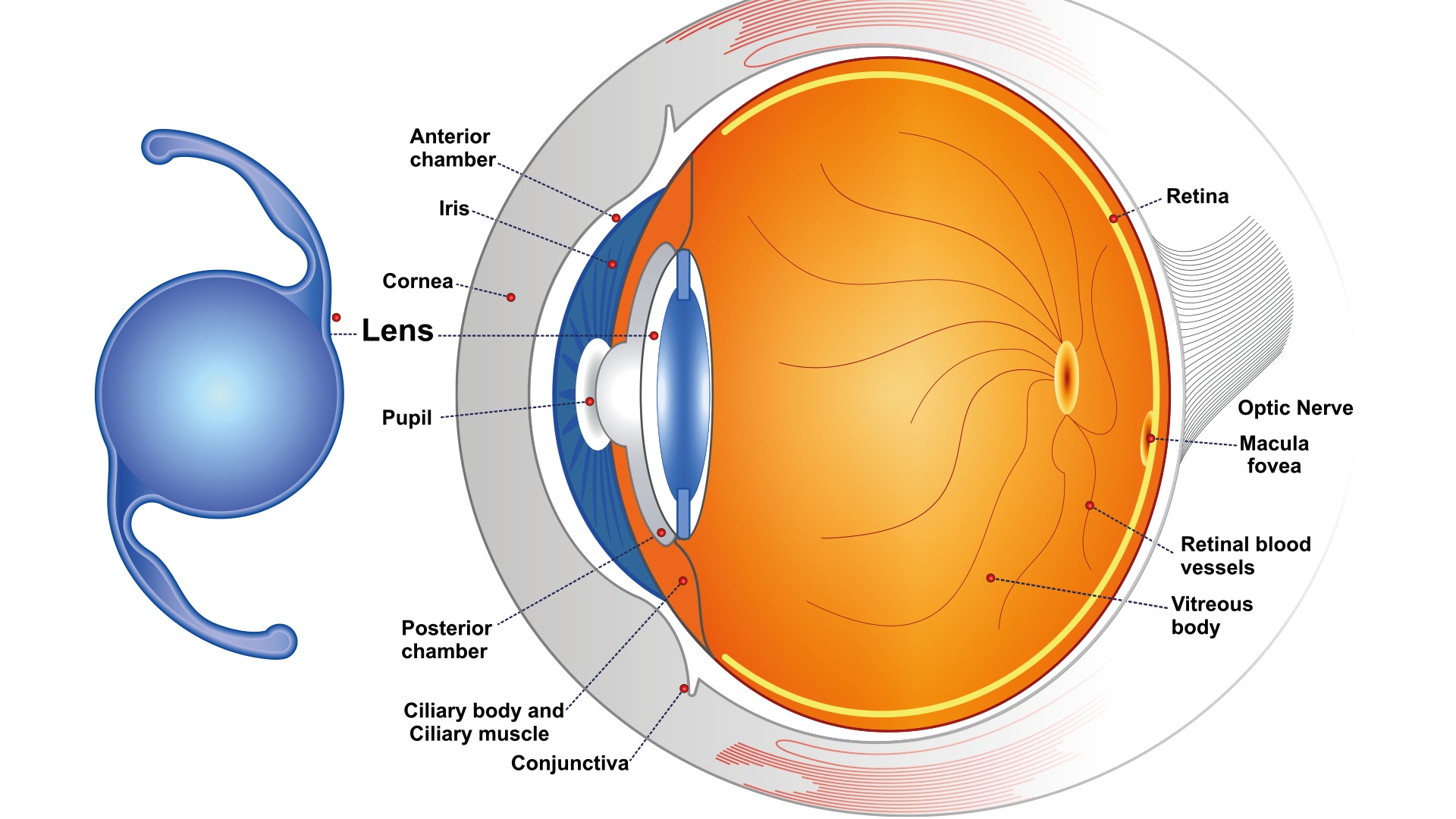 Les implants intraoculaires multifocaux Turquie — free download